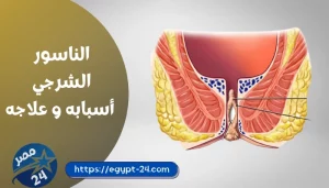 الناسور الشرجي أسبابه و علاجه