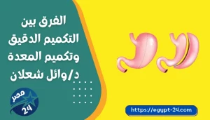 الفرق بين التكميم الدقيق وتكميم المعدة