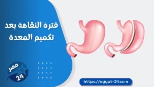 فترة النقاهة بعد تكميم المعدة